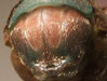 Cicada mesonotum pronotal collar